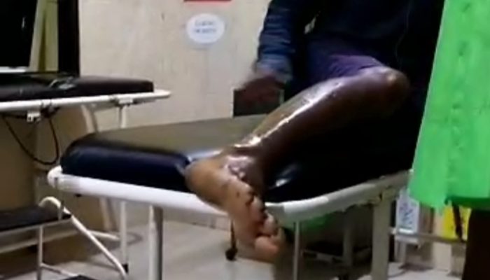 Diserang Anjing Gila, 7 Warga Sidrap Dilarikan ke Puskesmas